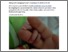 [thumbnail of Blog]