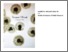 [thumbnail of Taraxacum Officinale installation for the Bradford Institute for Health Research]