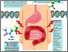 [thumbnail of UURIP NIHR Poster]